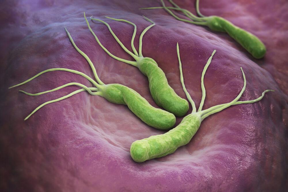 Helicobacter: bacteria, which in the stomach of the world's population