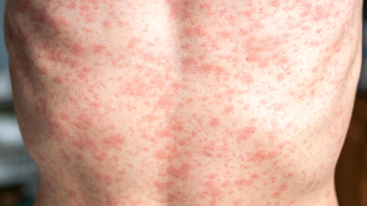 El niño murió en los platos: señales y necesidades de ayuda