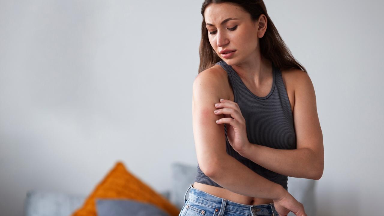Siga estas medidas para evitar las picaduras de mosquitos si viaja este verano