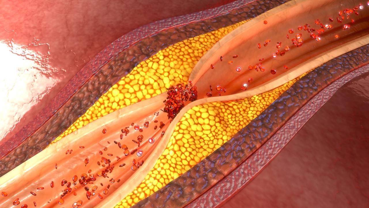 La tecnología de imagen española utilizada para el cáncer puede mejorar el acceso a las arterias